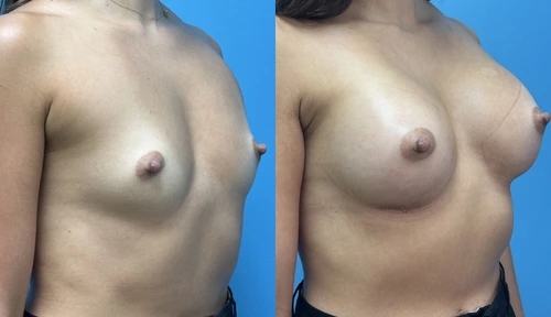 Before and After (1)